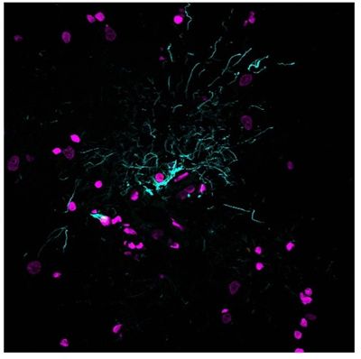 Lipofuscin autofluorescence was quenched using EverBrite TrueBlack&reg; Hardset Mounting Medium&reg;, allowing effective visualization of glial cells (GFAP antibody stain, cyan) and cell nuclei (magenta) in human cerebral cortex cryosections.