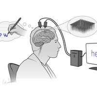 an illustration of a man with electrodes in his brain thinking about writing the word "hello," and the word appearing on a computer screen 