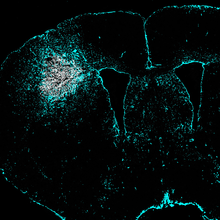 outline of a brain slice with white patch surrounded by teal
